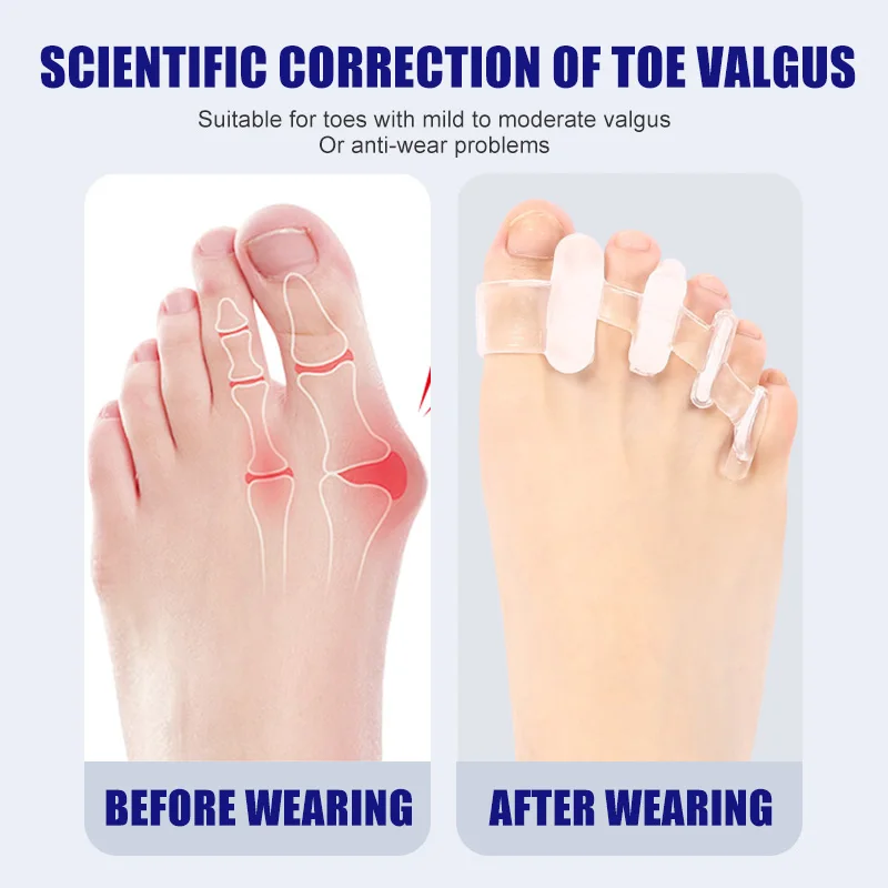 1 çift Silikon Ayak Ayırıcı Bu - Yoga Toe Separator incelemesi ve fiyatı
